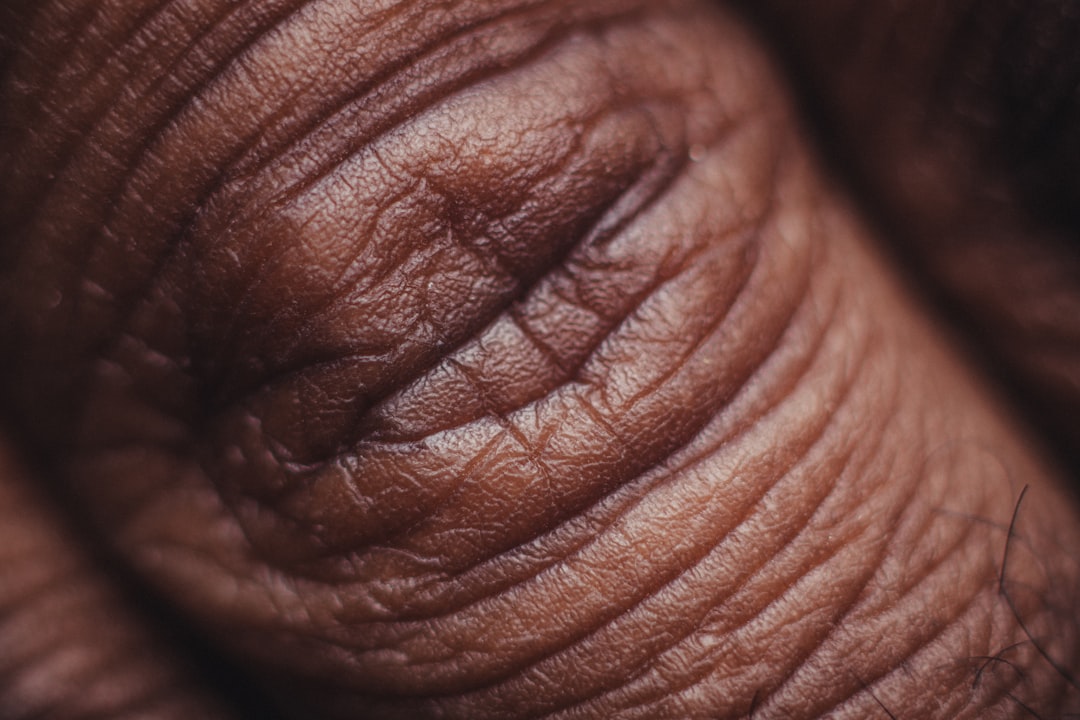 Active Skin Repair: Healing Your Skin Naturally